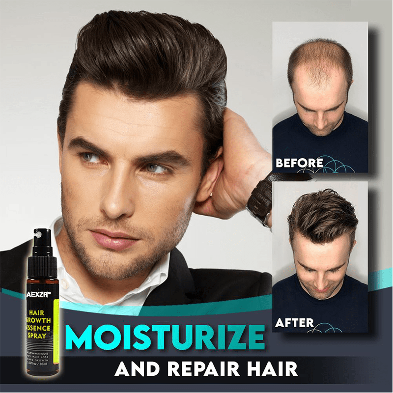 Aexzr™ Hair Regrowth Roller+Essence